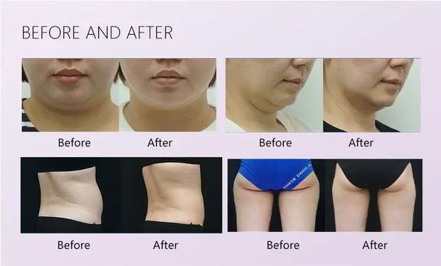 2025NEW Inner Ball Roller Massage Body Contouring Equipment WeightLoss Cellulite Reduction Slimming Beauty Massager Machine 7W
