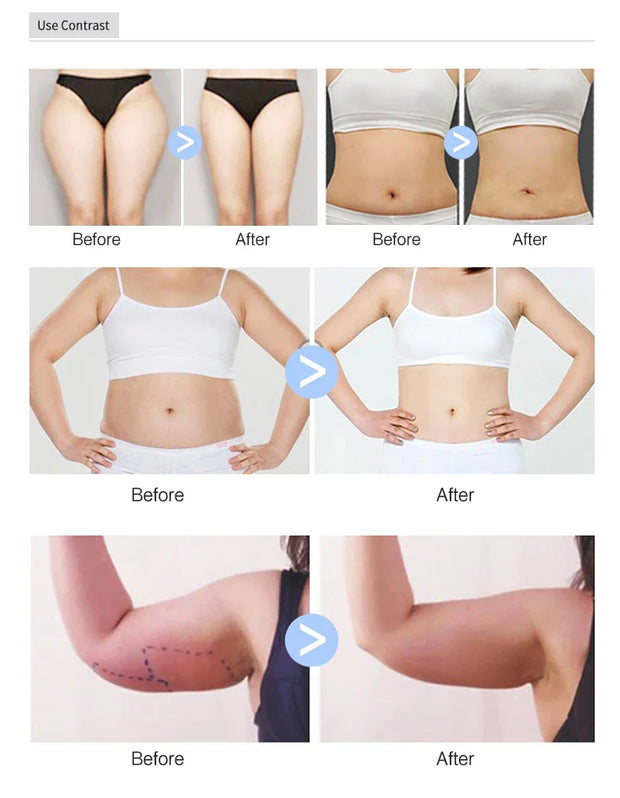 2025NEW Inner Ball Roller Massage Body Contouring Equipment WeightLoss Cellulite Reduction Slimming Beauty Massager Machine 7W