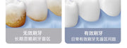 OCLEAN Xpro Sonic Electric Toothbrush Electric Toothbrush Visual Screen Intelligent Couple Male Female Adult Soundwave Style QH2